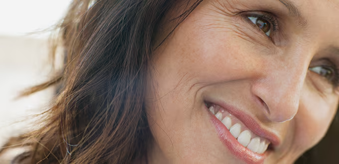 Dysport® cosmetic wrinkle treatment – crow’s feet