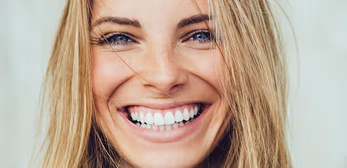 Go smile™ teeth whitening treatment