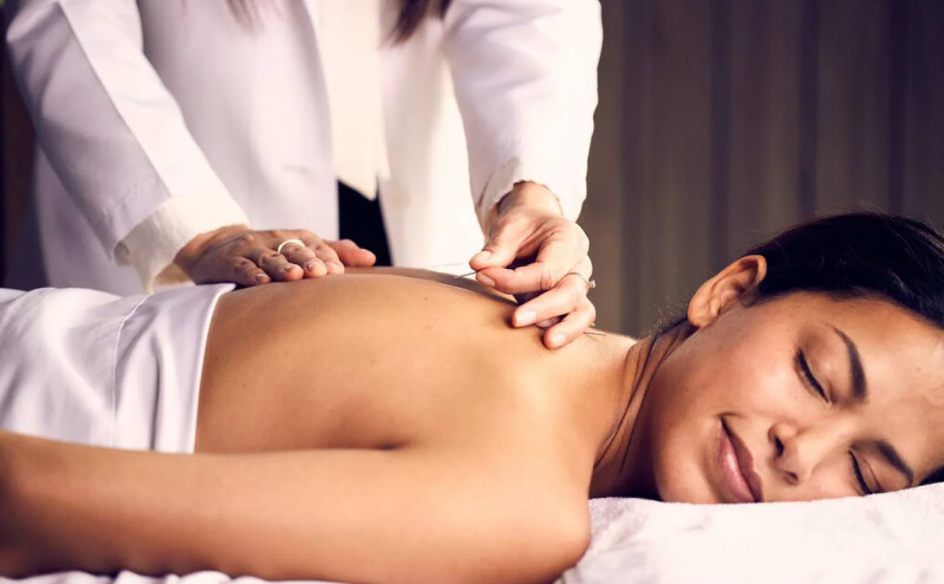 Acupuncture