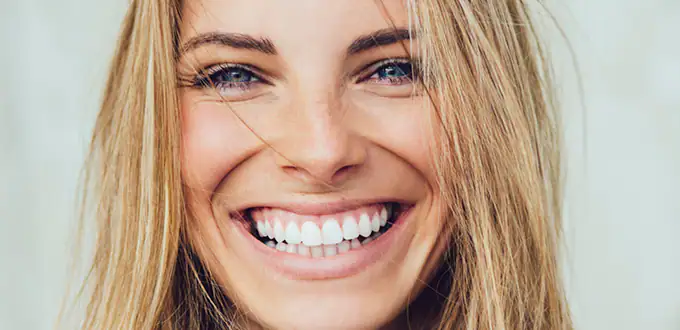 Go smile™ teeth whitening treatment