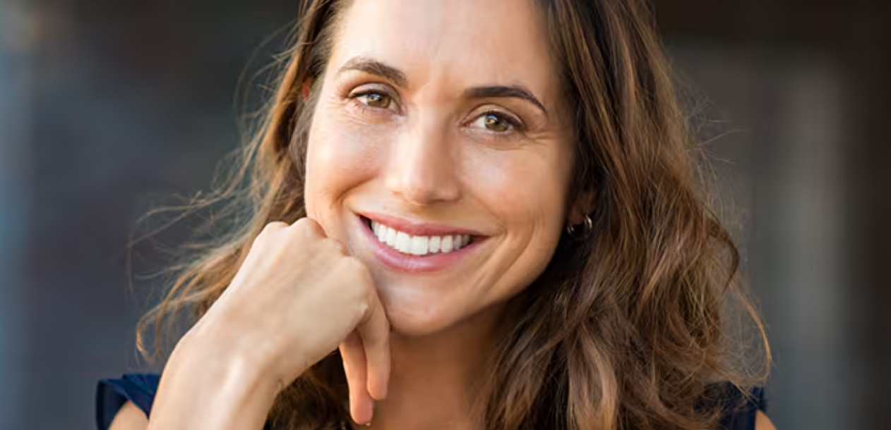 Restylane® smile lines treatment