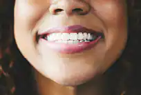 Restylane® lip lines treatment