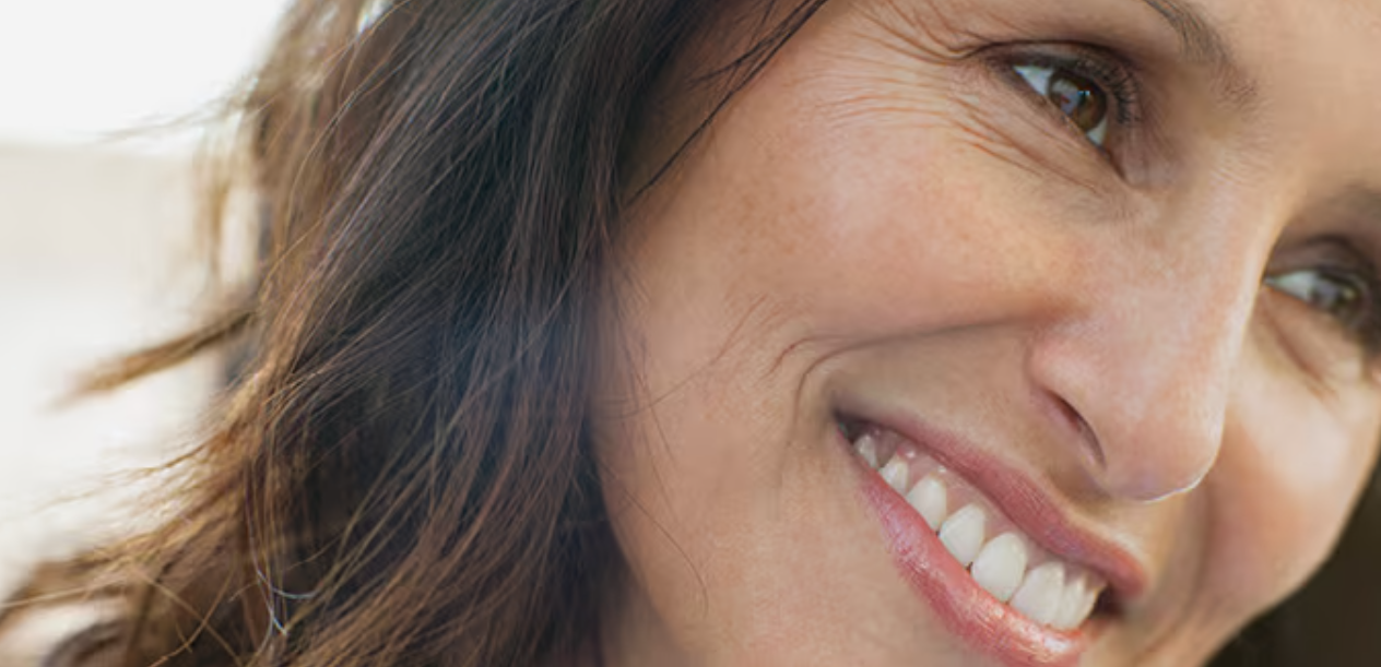 Dysport® cosmetic wrinkle treatment – crow’s feet