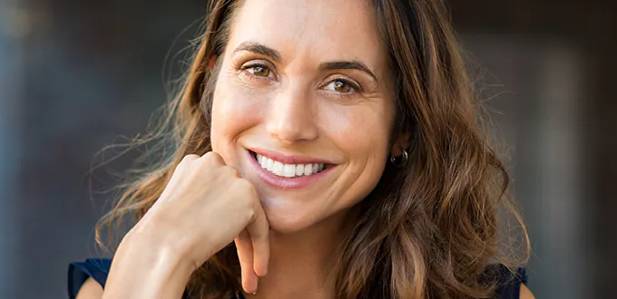 Restylane® marionette lines treatment