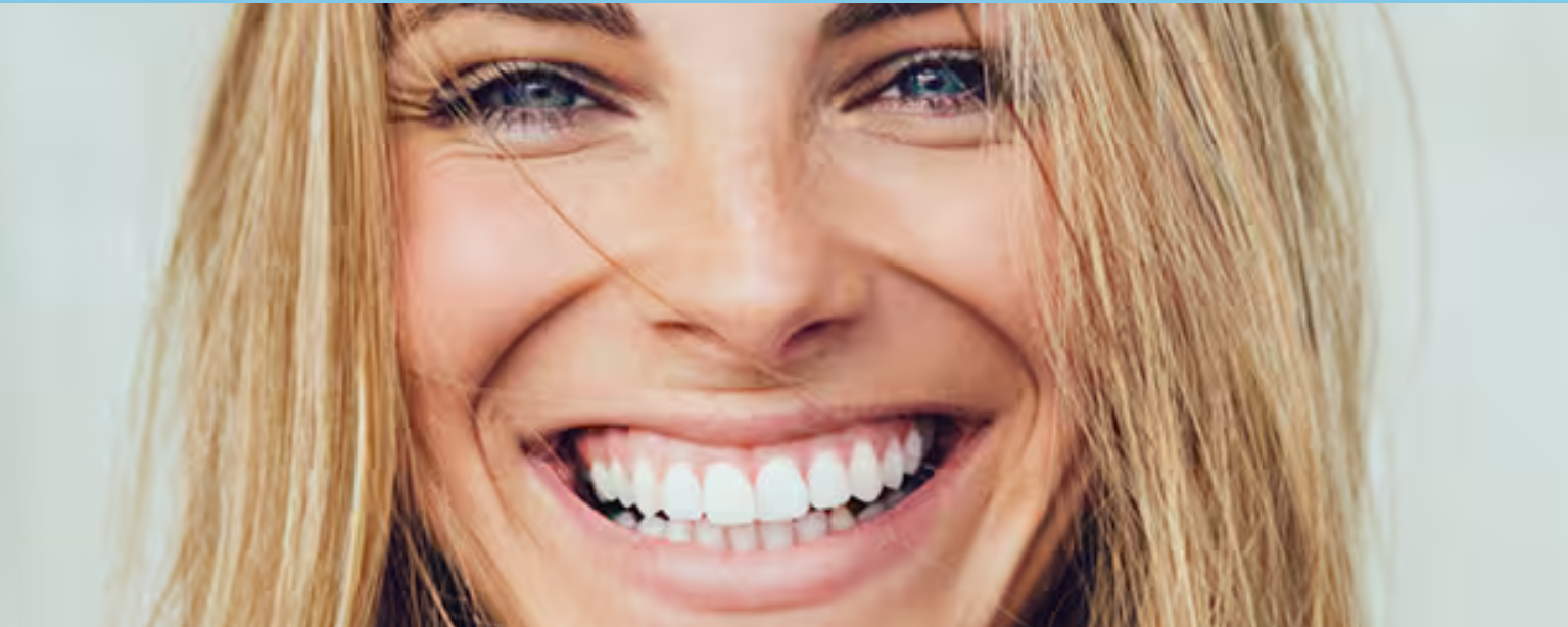 Go smile™ teeth whitening treatment